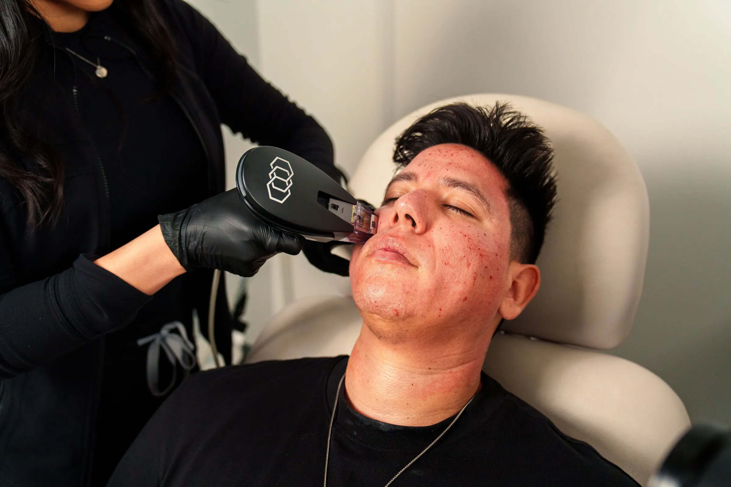 Man reclining during a facial device treatment from a gloved provider